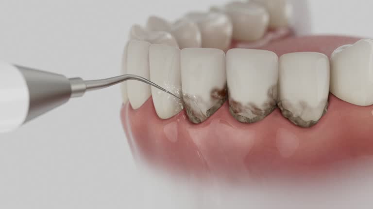 Trusted Wisdom Tooth Removal service in Nicholson, MS - Dentist Open Now